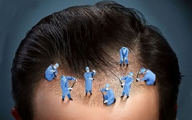 Hair Transplant Treatment cost in Tellapur